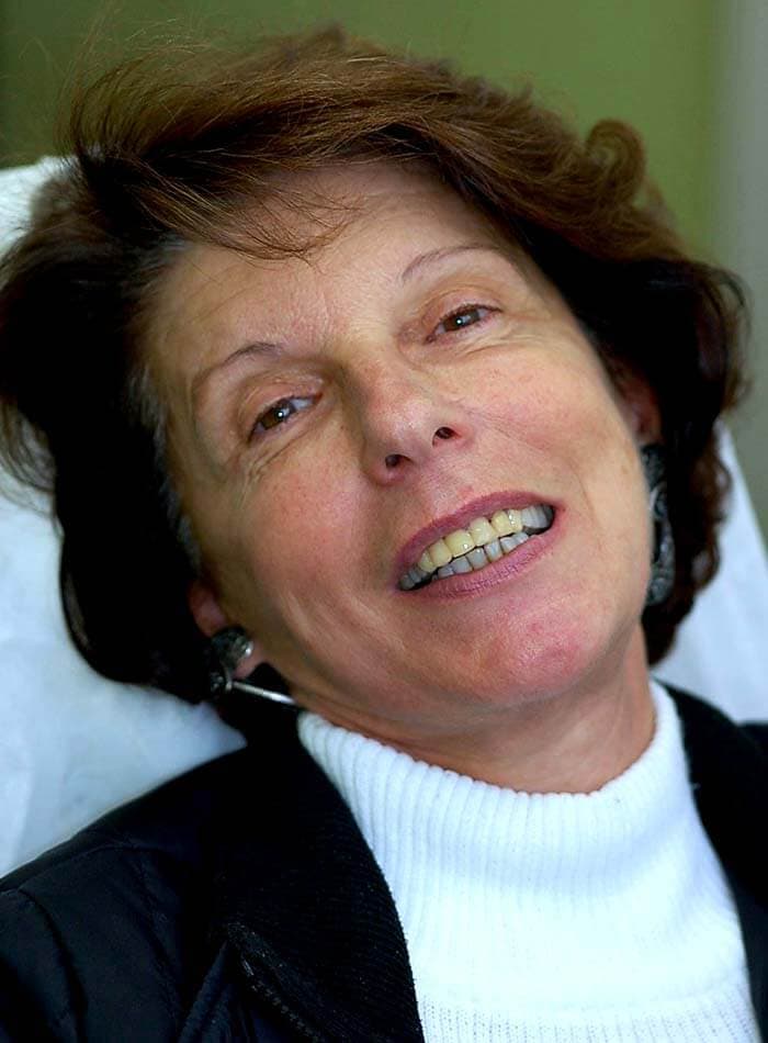 Smile before treatment, case 08